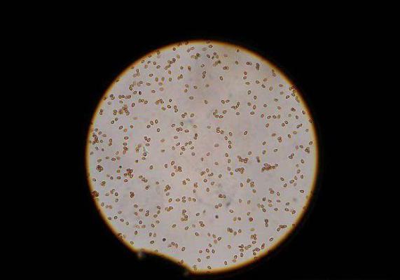 如何用麦粒保藏灵芝菌种？