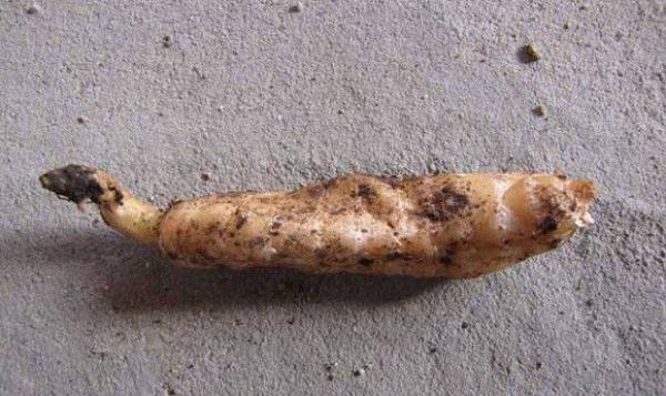 什么是天麻麻性退化？